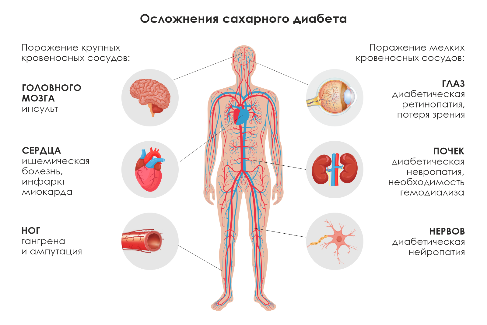 Осложнения сахарного диабета